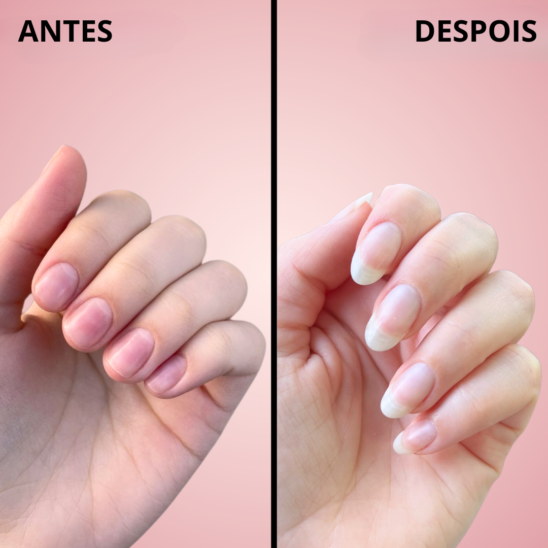 Sérum Fortalecedor de Unhas com Óleo Nutritivo (EM PROMOÇÃO 2X1)